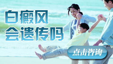白癜风会遗传吗 白癜风会遗传吗