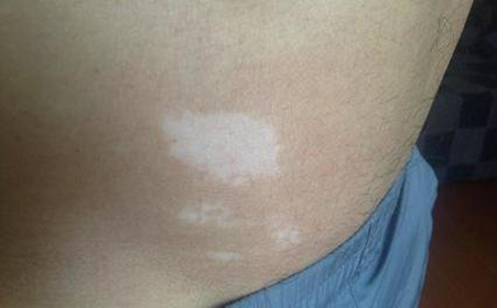 °×ñ°·çͼƬ °×ñ°·çͼƬ