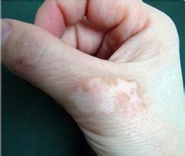 °×ñ°·çͼƬ °×ñ°·çͼƬ